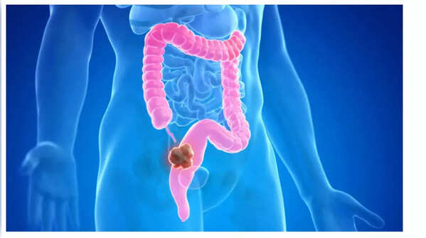 Illustration depicting rapid weight loss
