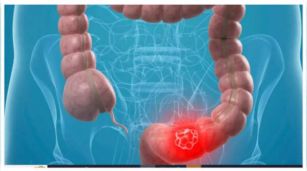 Illustration of someone experiencing abdominal pain